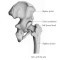 Hip Structure, Function and Common Problems