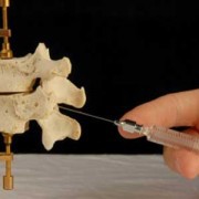 Epidural