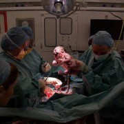 Cesarean Section