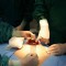 Appendectomy and Appendicitis