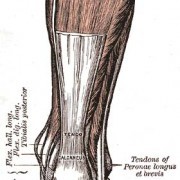 Achilles Tendonitis – Symptoms, Diagnosis and Treatment