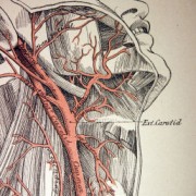 Carotid Artery Disease, Endarterectomy and Stenting