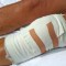 Recovery After Outpatient Surgery