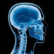 Craniotomy