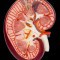 Kidney Failure