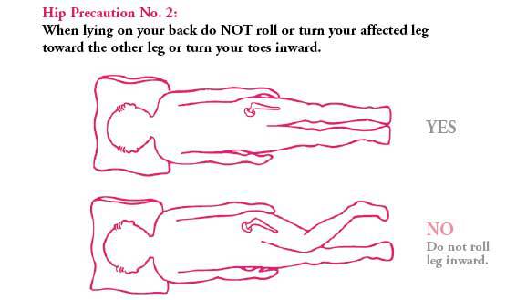 Hip Precautions After Hip Surgery